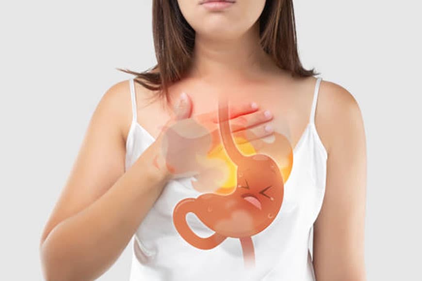 Gastroesophageal reflux treatment with homeopathy